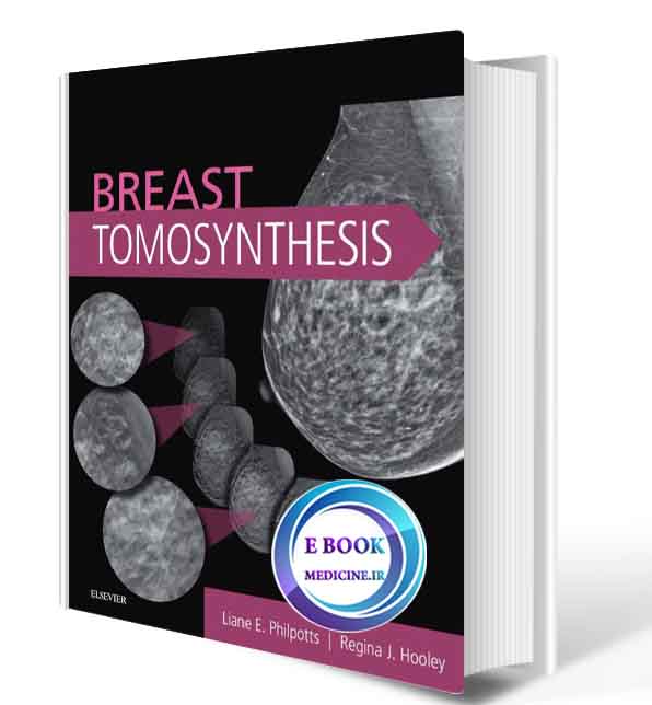 دانلود کتاب Breast Tomosynthesis 2017 (ORIGINAL PDF)  